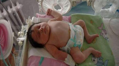 Boynunda dev kanserle doğan bebeklerin hikayesi