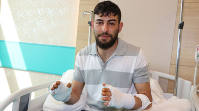 Hararet yapan aracına sarılınca elleri yandı