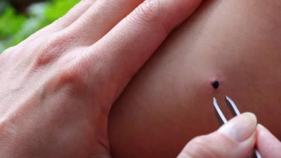 Keneleri mıknatıs gibi çekiyor! Sakın bu giysileri giymeyin