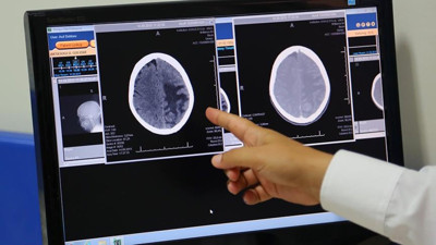 Beyindeki tuzak mucize ameliyatla ortadan kaldırılıyor