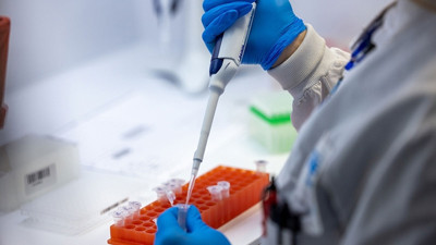 Gana'da M çiçeği tehlikesi! Dört kişide tespit edildi