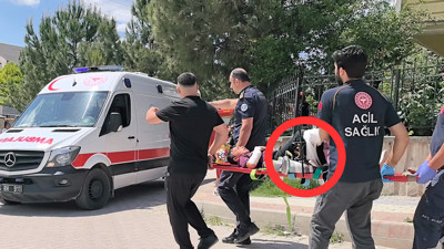 Bacağına saplanan demirle hastaneye gitti