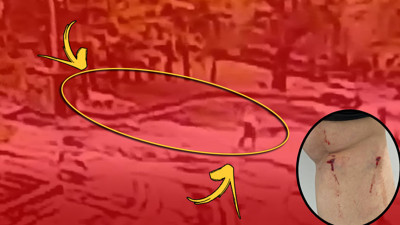 Yıldız Teknik’te köpek dehşeti! Üniversiteli Gözde hastanelik oldu: Çığlıkları kampüsü inletti