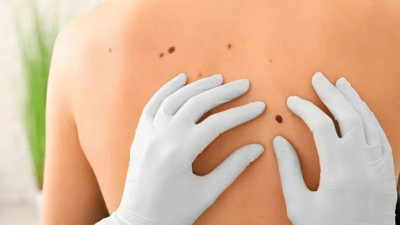 Beni olanlar dikkat! Ölümcül olabilir! Uzmanlardan hayat kurtaran uyarılar