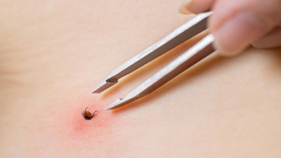 İl Sağlık Müdürlüğü’nden erken tedbir uyarısı!