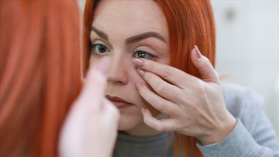 Lens kullanacaklar dikkat! Güzel göreyim derken gözlerinizden olmayın