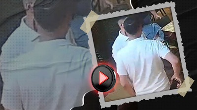 Kafede dehşet! Kızgın müşteri garsonun burnunu ısırarak kopardı