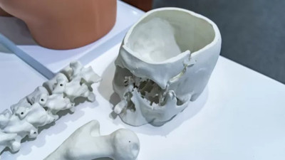 Organ naklinde yeni çağ! 3D baskı ile organ üretimi