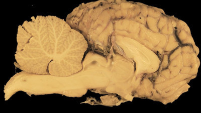 Beyne iyi gelen besin! Günde 5 tane yemek yeterliymiş