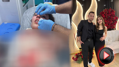 Nişanlısının burnunu kafasıyla kırıp kaçtı! 20 yaşındaki genç kız şikayetçi oldu
