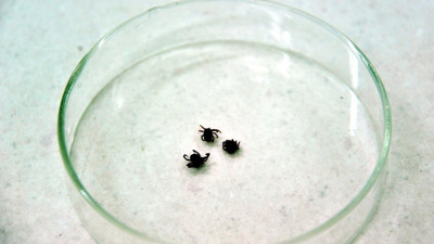 KKKA hastalığı şüphesiyle tedavi gören kadından acı haber!