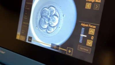 Tüp bebekte yapay zeka dönemi!