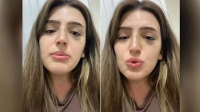 Eşinden şiddet gördü! Çektiği videoyla yardım istedi