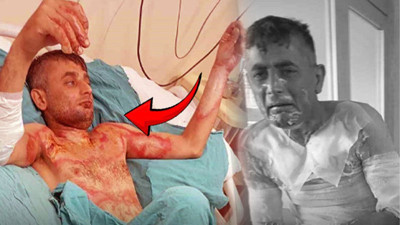 Engelli vatandaşa arazide dehşeti yaşattı: Benzin döküp diri diri yaktı!