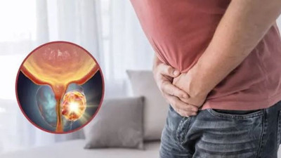 Prostat kanseriyle savaşta Akdeniz diyetiini gizli gücü ortaya çıktı