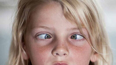 Çocuklarda şaşılığın görünmeyen yüzü! İşin uzmanlar anlattı