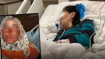 Bakım merkezinde kan donduran olay! Kadının gözlerini oydu