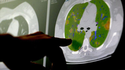 Pandemi beyinleri nasıl etkiledi? Şok edici araştırma sonuçları! Uzmanlar tek tek anlattı