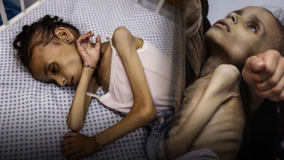 Gazze'deki insanlık dramı derinleşiyor! 9 yaşındaki Meryem 10 kiloya düştü