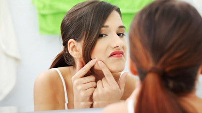 Cilt sağlığında devrim yapacak doğal çözüm! Sivilce kabusunu bitiriyor