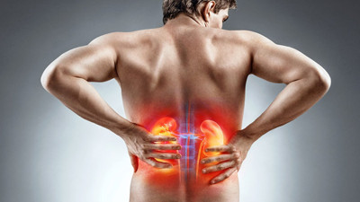 Böbrek taşını tetikleyen gizli tehlike! Uzmanlar bakın ne diyor!