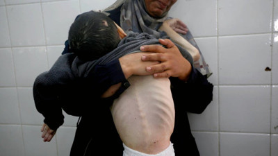 Bir yanda katliam, bir yanda açlık! Gazze'de can kaybı 61 bin 430 oldu