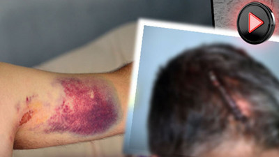 Yeğenine beyzbol sopasıyla dehşeti yaşattı!