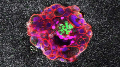 Kısırlık derdine umut oldu: Embriyosunun rahme yerleşme anı ilk kez görüntülendi