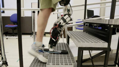 Sinir sinyalleriyle çalışan protez devrimi! Zihnin gücüyle hareket