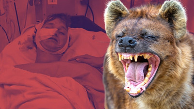 Kamp tatili kabusa döndü: Sırtlan saldırısından 30 dikişle kurtuldu