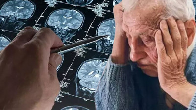 Alzheimer’ın 8 gizli tetikleyicisi ortaya çıktı! Kadınlar mı, erkekler mi daha tehlikede?