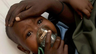 M çiçeği kabusu: Gana'da vakalar hızla artıyor!