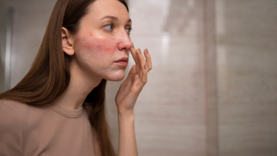 Ciltteki gizli tehlike kanser alarmı veriyor! Gizli hastalık haritaları hayatı kurtarıyor