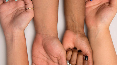 Buruşan damarların şifası olan mucize bitki ortaya çıktı