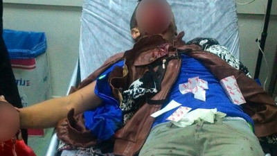 Polise atmak istediği bomba elinde patladı