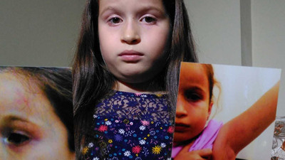 Diş doktoru 8 yaşındaki İrem'i darp etti