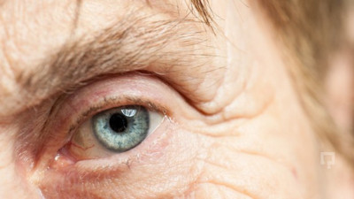 Katarakt ameliyatı nedir, nelere dikkat etmek gerekir?