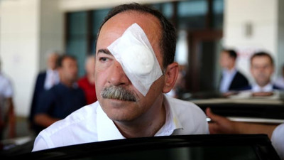 Edirne Belediye Başkanı Recep Gürkan’a saldıran şahıs tutuklandı