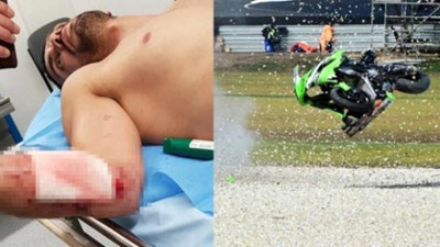 Kenan Sofuoğlu ölümden döndü (24 Şubat 2018)