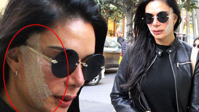 Sevda Demirel Kim Kardashian'a benzemek için ameliyat oldu