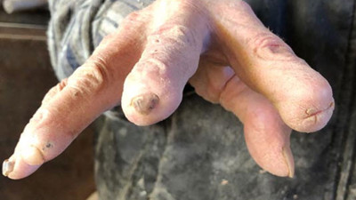 72 yıldır yaptığı iş ellerini bu hale getirdi!