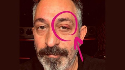 Cem Yılmaz nazara geldi