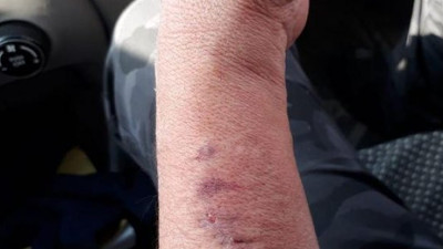 HDP'li vekil polisin kolunu ısırdı