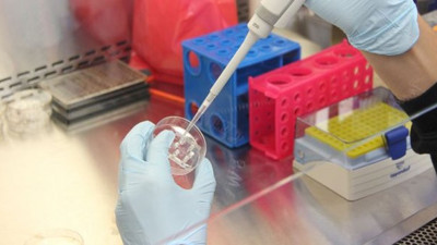 Multipl miyelom kanserinde yeni tedavi umudu