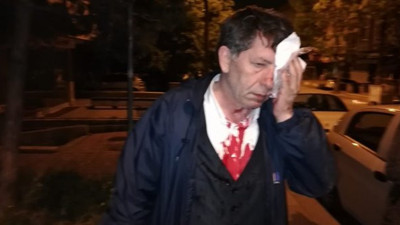 "Ona saldırı Türk'e yapılmıştır"