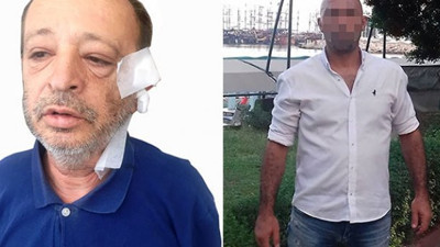 Kendisini polise ihbar eden arkadaşından böyle intikam aldı