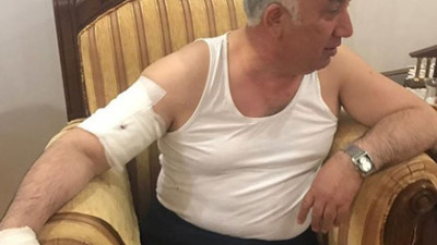 Belediye Başkanı'na yardım götürdüğü evde köpek saldırdı