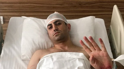 Murat Alan'a saldırıda 3 gözaltı