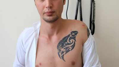 Tartıştığı kişi tarafından ısırılınca kuduz aşısı oldu