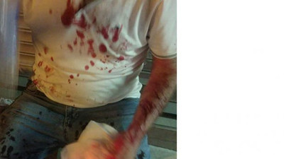 İmamoğlu'na destek vereceğini söyleyen bir İYİ Partili daha saldırıya uğradı!